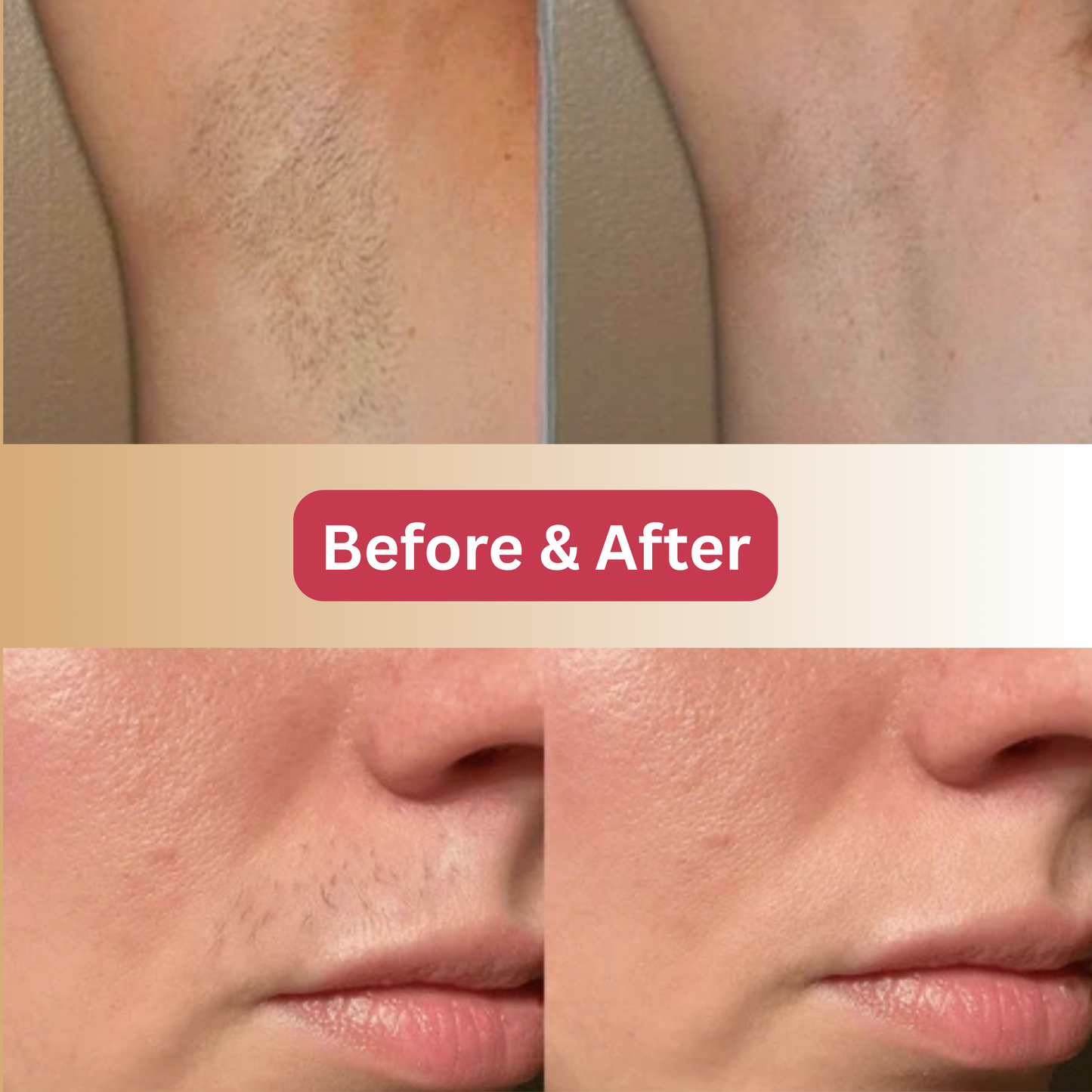 Blyza™ Cyperus Rotundus Root Serum